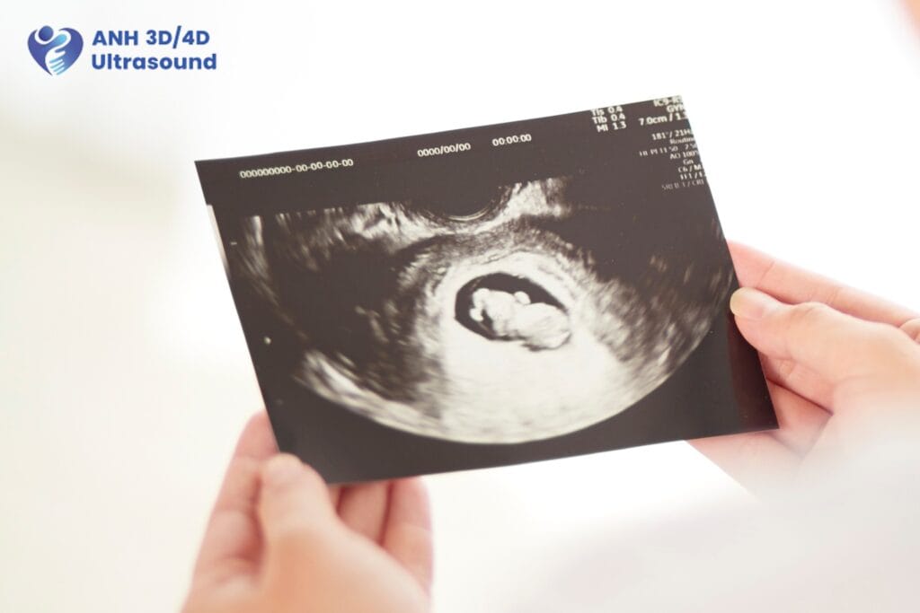 Hands holding an early pregnancy ultrasound image showing the developing baby during a routine prenatal scan at ANH 3D/4D Ultrasound.