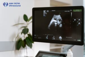 Ultrasound machine screen displaying a pregnancy scan in the ANH diagnostic clinic